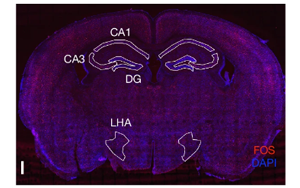 Nature：科學家發現記憶如何控制新陳代謝
