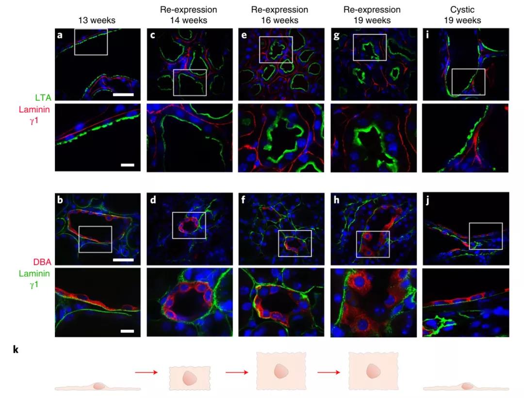 無需腎移植！Nature子刊：科學家通過逆轉小鼠多囊腎病揭示腎臟的可塑性