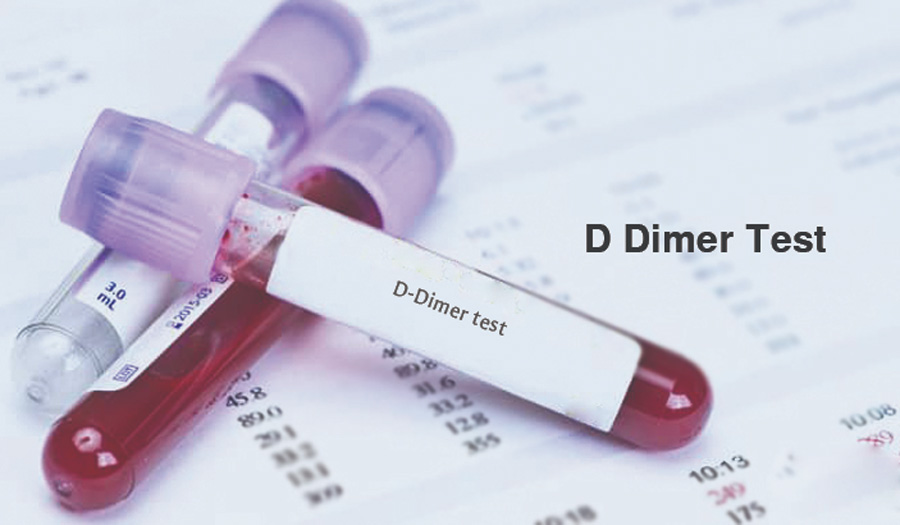 D-Dimer檢測(cè) D-Dimer檢測(cè)